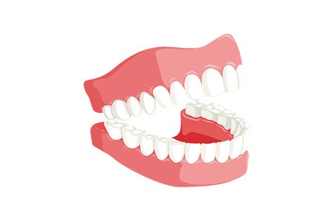 What are overlapping teeth called?