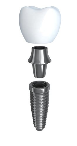 Who is not a good candidate for dental implants?