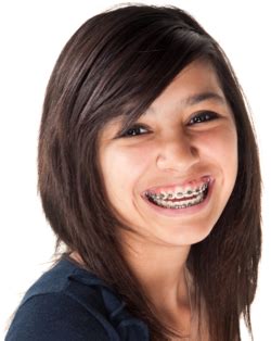 What is the most painful part of braces?
