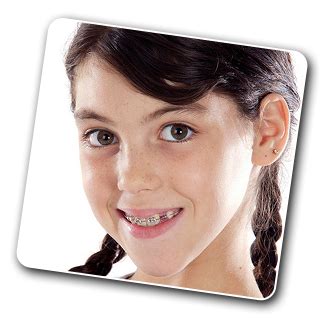 Which teeth are the hardest to move with braces?