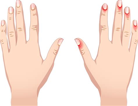 Does dip make your nails stronger or weaker?