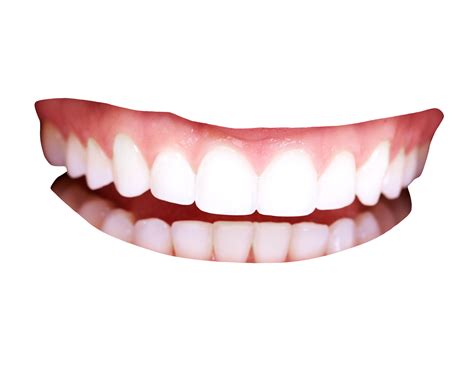 How do you stop my gums from showing when I smile?