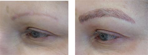Why didn't my eyebrows scab after microblading?
