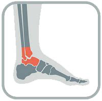 What are the two types of ankle instability?
