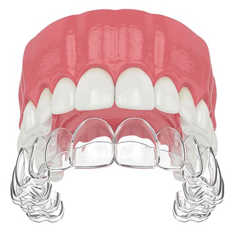Can a tight retainer move teeth back?