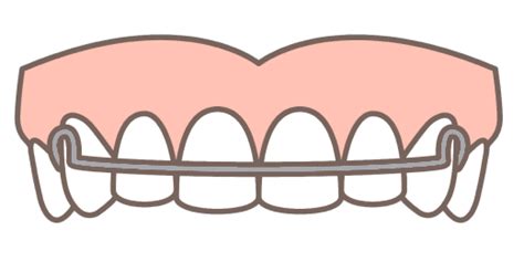 How much will teeth move without retainer?