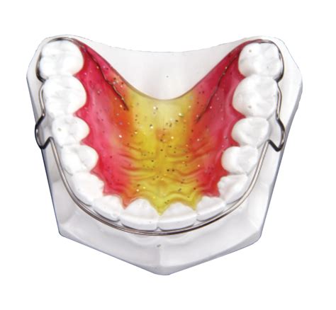 How long does it take for your retainer to fit again?