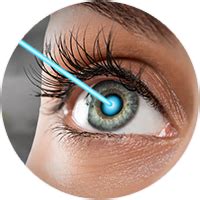 Why does LASIK only last 10 years?