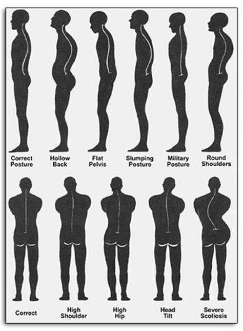 What is ideal body alignment?