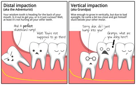 Are we evolving without wisdom teeth?